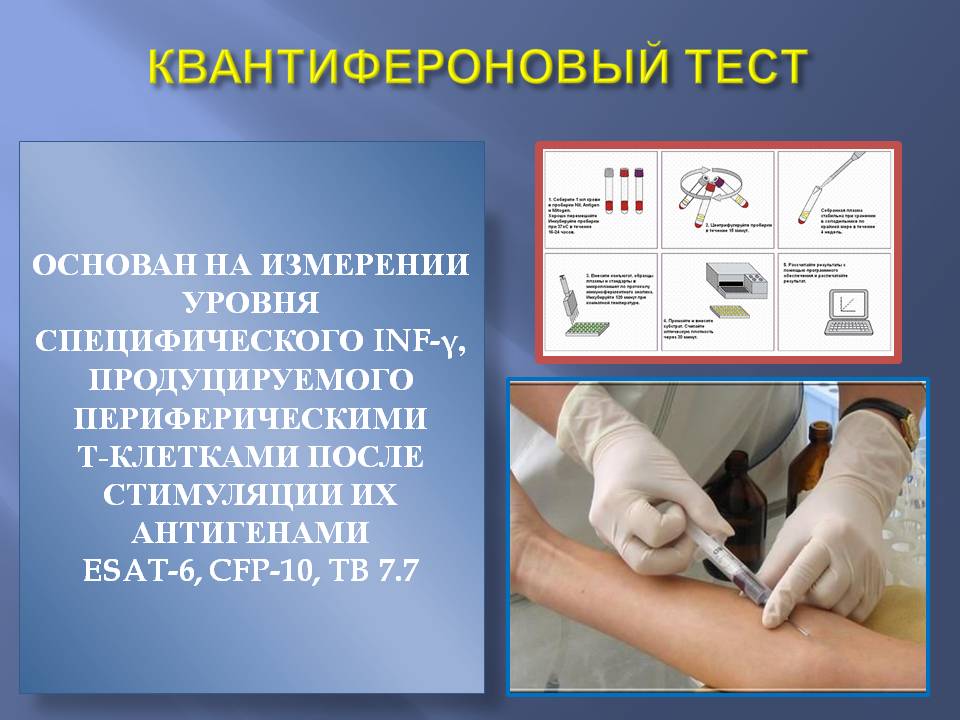 Купить справку квантифероновый тест в Москве Купить справку квантифероновый тест с доставкой в Москве